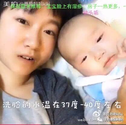 婴儿湿疹头垢洗了之后一直在出水,新生儿头垢和湿疹结痂的区别