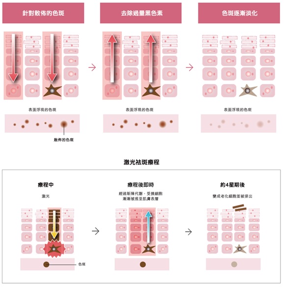 美白淡斑医学产品,美白淡斑全套