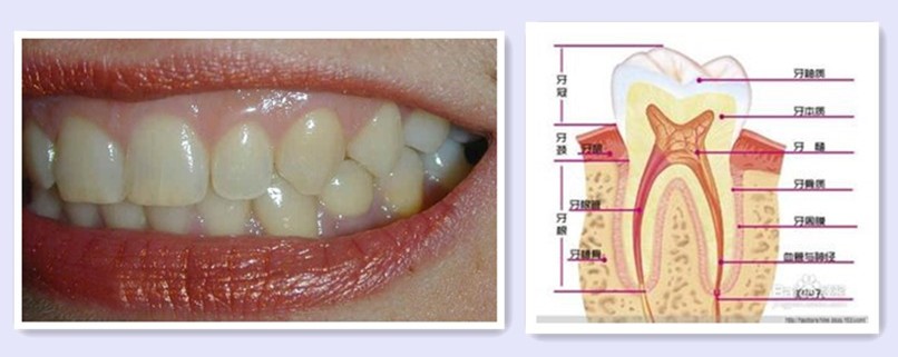 牙齿变白最有效的方法,想让牙齿变白做什么项目好