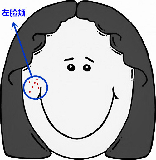 超级齐全的痘痘护理，有痘痘的妹子抓紧收藏