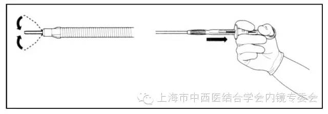 消化内镜仪器操作,消化内镜护理操作名称