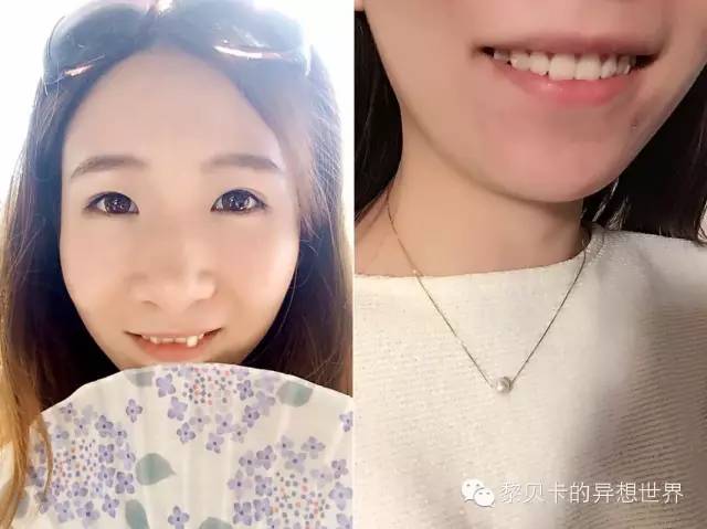 她们说||那些年整牙吞下的血和泪,终于换来最开怀的大笑