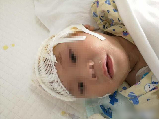 孩子个头偏小看医生有没有用,给宝宝检查头部必须去儿童医院吗