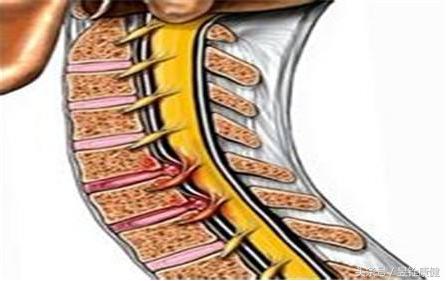颈椎病这些知识您了解吗,颈椎病常见康复治疗方法