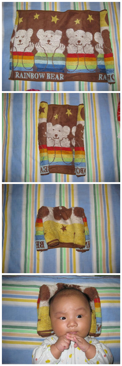 宝宝偏头莫担忧预防纠正有妙招,宝宝偏头的最佳治疗方法