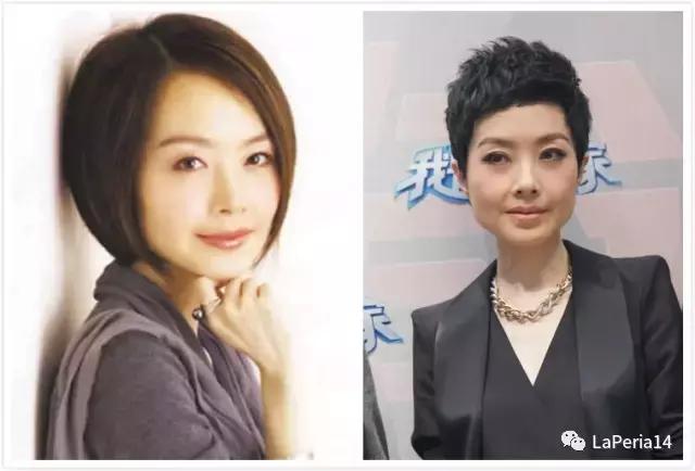 骨性方脸怎么瘦脸,方脸怎么改善脸型整骨