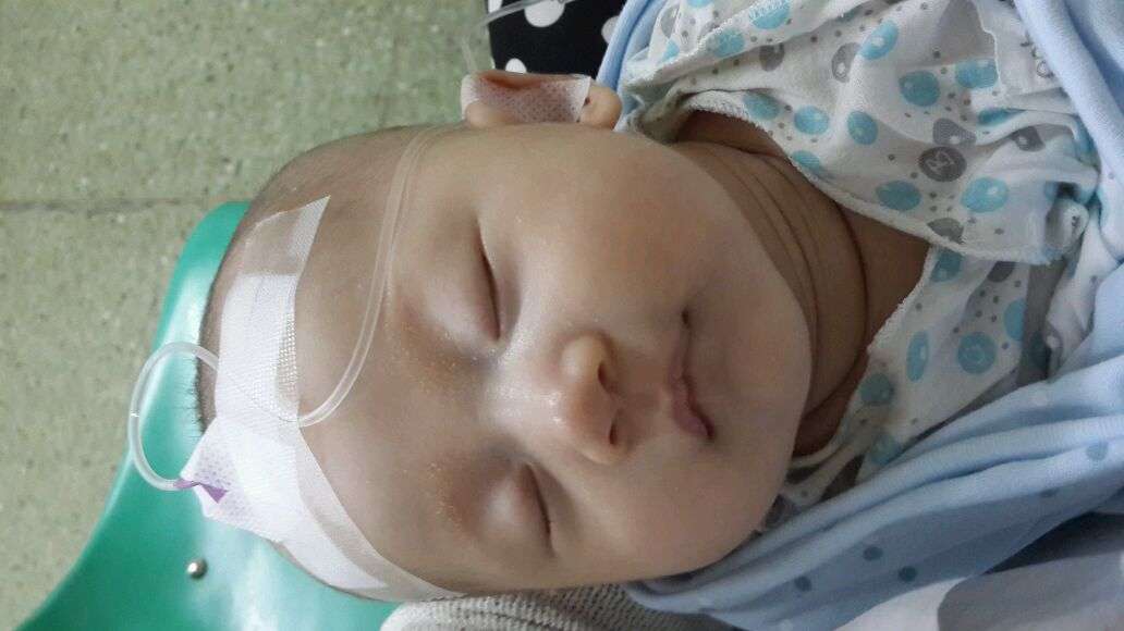 儿童炎症体质如何改善,儿童最好的预防疾病的办法