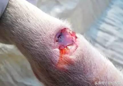 每种细菌性疾病都有一款特效药专克它，这篇文章讲全了