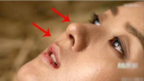 粉刺黑头去除最快方法,黑头虫怎么去除最快方法