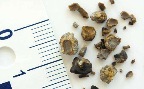 结石会不会影响宝宝,孕期结石发作了怎么缓解