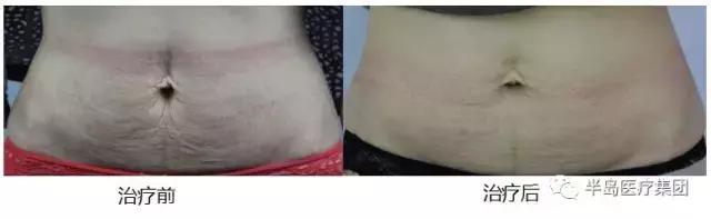 准妈妈要知道的孕期知识,准妈妈孕期常识科普节目