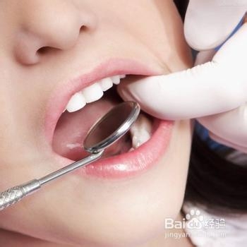 什么是智齿引起牙根疼,什么是智齿智齿有哪些类型