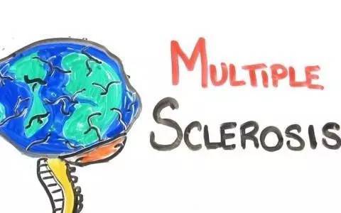 左眼跳是好事还是坏事的征兆,左眼跳是有好事发生还是坏事发生