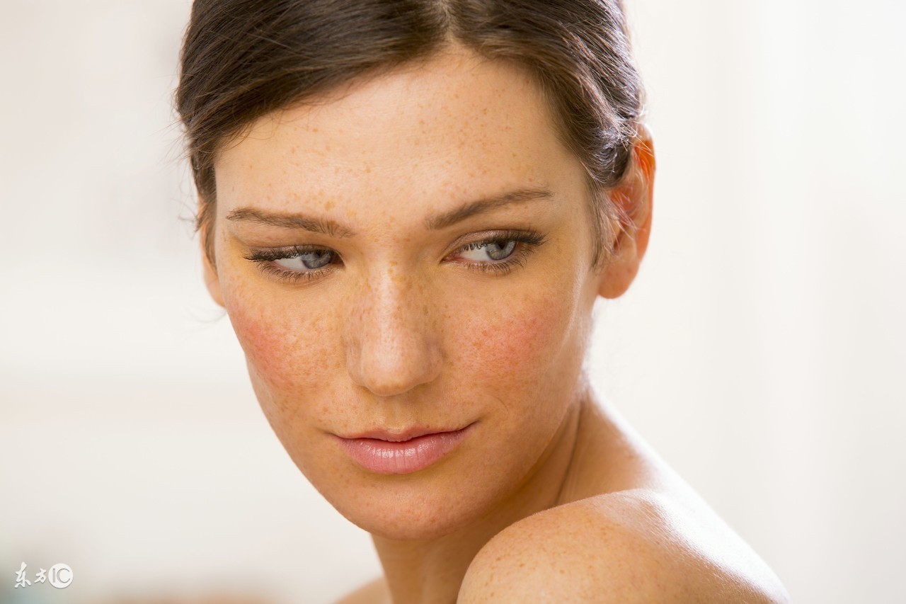 雀斑是什么原因引起的怎样去掉呢,雀斑应该怎么处理