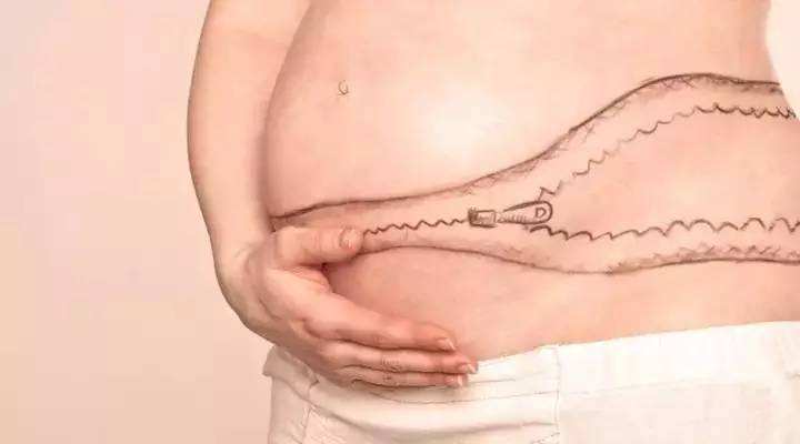 为什么产后伤口越来越疼,产后伤口特别痒怎么缓解