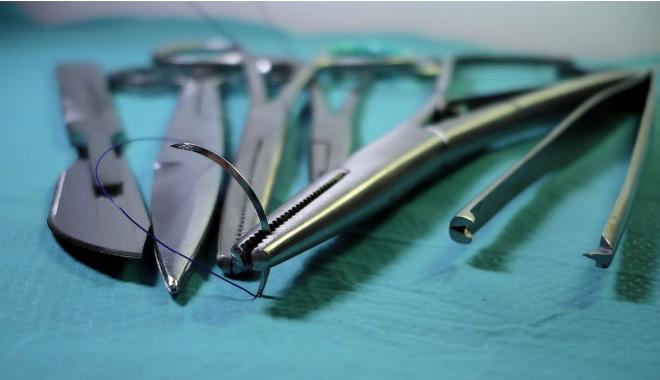 亲身经历碘油造影，有点可怕有点痛