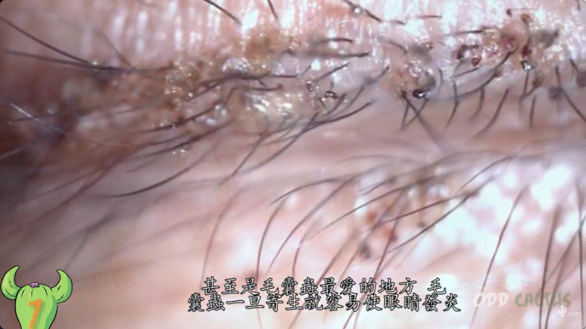 人体最脏的部位对身体的好处,人体最脏的十大部位是哪