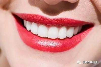 牙齿的好坏跟什么有关,牙齿越多越富贵吗