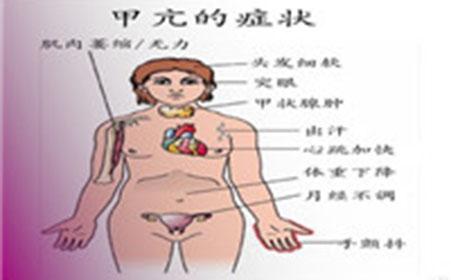 更年期女性甲亢最明显的症状,更年期和甲亢同时发病的结果