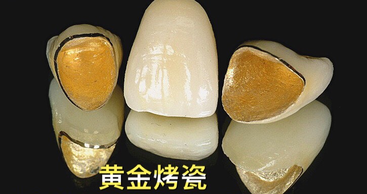 真正的烤瓷牙,烤瓷牙的真实感