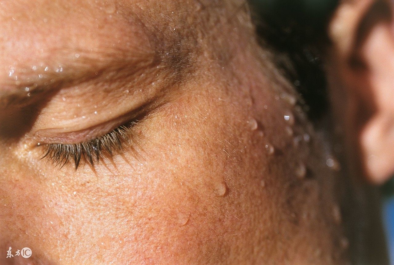 爱出汗是排毒养颜？别傻了，可能是身体在释放求救信号！