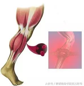 运动中肌肉拉伤最佳处理方式,运动中肌肉拉伤怎么治