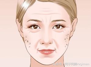 吃三七粉斑反而重了,吃多长时间三七粉斑可以淡化掉