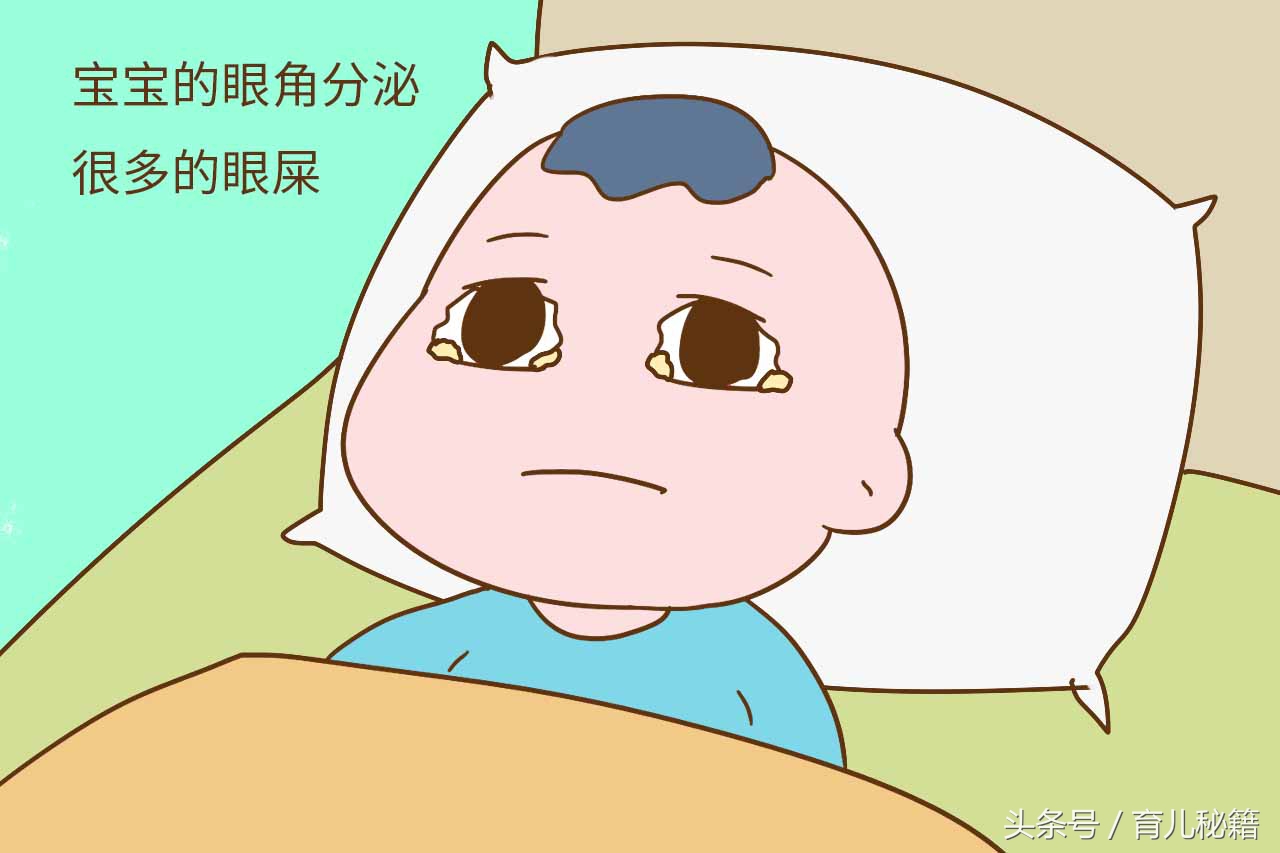 婴儿上火怎么快速消火,孩子5种上火的表现