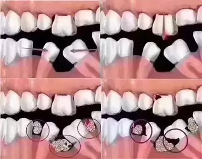 牙齿松动咬不动硬的菜怎么回事,牙齿咬硬物后松动是怎么回事