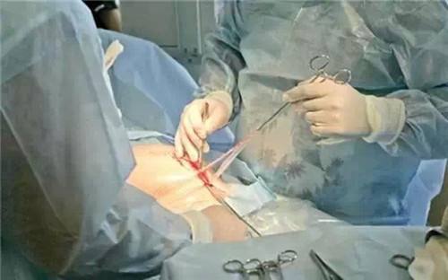 想剖宫产可没那么简单，必须符合以下14条指征，否则只能自然分娩