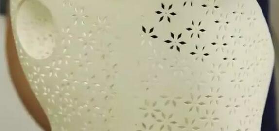 案例l3D打印支具助力青少年脊柱侧弯保守治疗