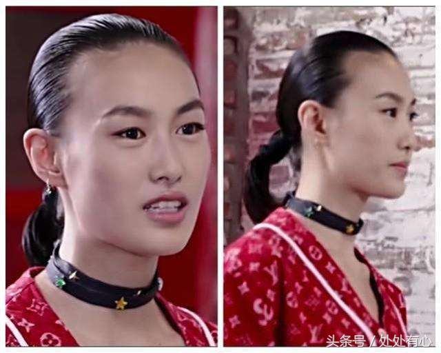 产后脱发生发密发的最好方法,秦舒培和刘雯发际线