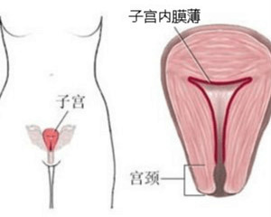 子宫内膜增厚有可能是怀孕吗,子宫内膜增厚有息肉能怀孕不