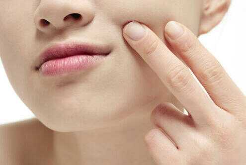 脸上毛孔里挤出白色条状是螨虫吗,脸上长螨虫的表现你中招了吗