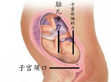生孩子分娩有多痛最高达到几级,生宝宝宫缩到顺产疼痛难忍