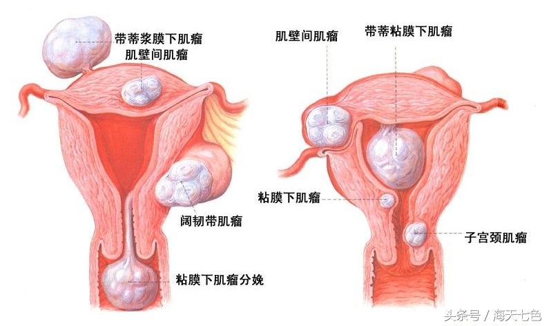 艾灸调理强身健体,艾灸对抗感冒