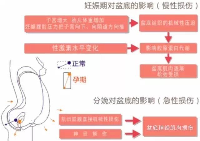 产后康复避雷点,产后修复红光理疗仪器
