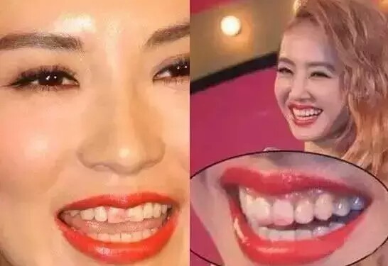 尴尬,你的口红沾到牙齿上了!