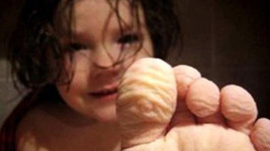 洗澡时间久了手皱是怎么回事,洗完澡手上有褶皱有什么危害吗