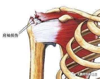 没有骨折但手伸不直,没有骨折但是还是疼痛
