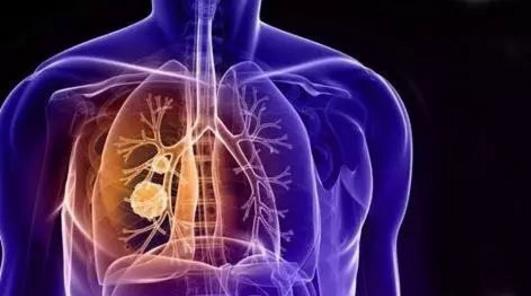 因肺结核死掉的名人,林徽因肺结核晚期的遗言