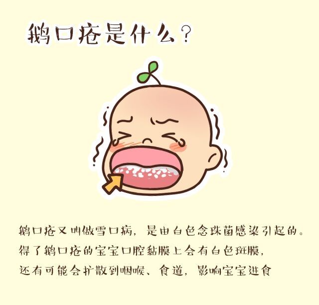 制霉菌素片治疗婴儿鹅口疮怎么用,婴儿鹅口疮的快速治疗方法