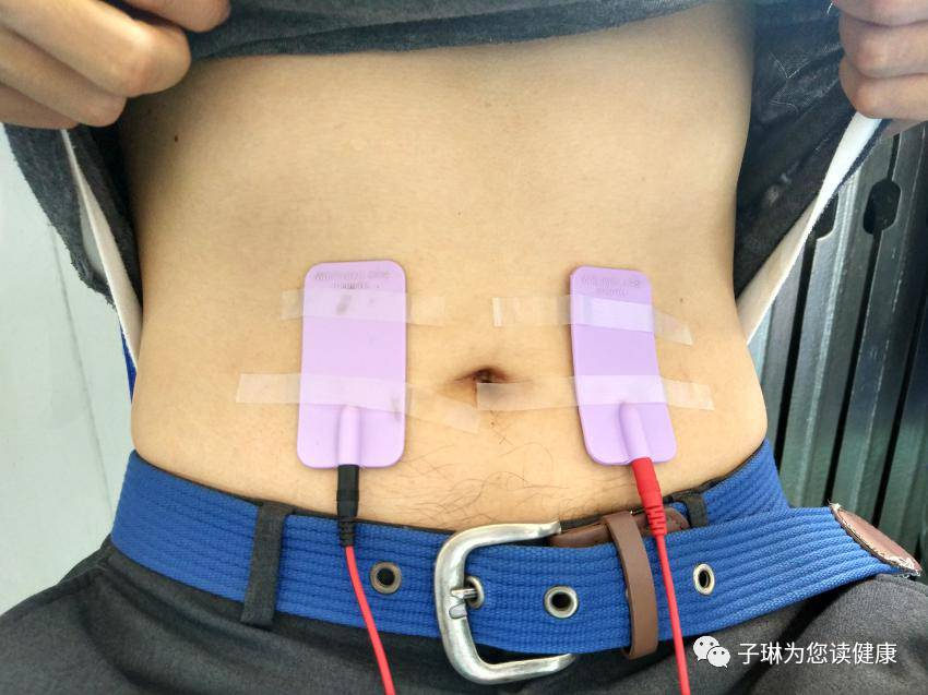 防止生孩子的神器,生孩子必备神器