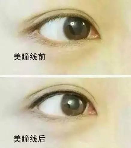 大部分人适合的美瞳,现在做美瞳的人多吗