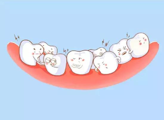 牙齿矫正出现黑三角,儿童牙齿矫正会出现黑三角吗