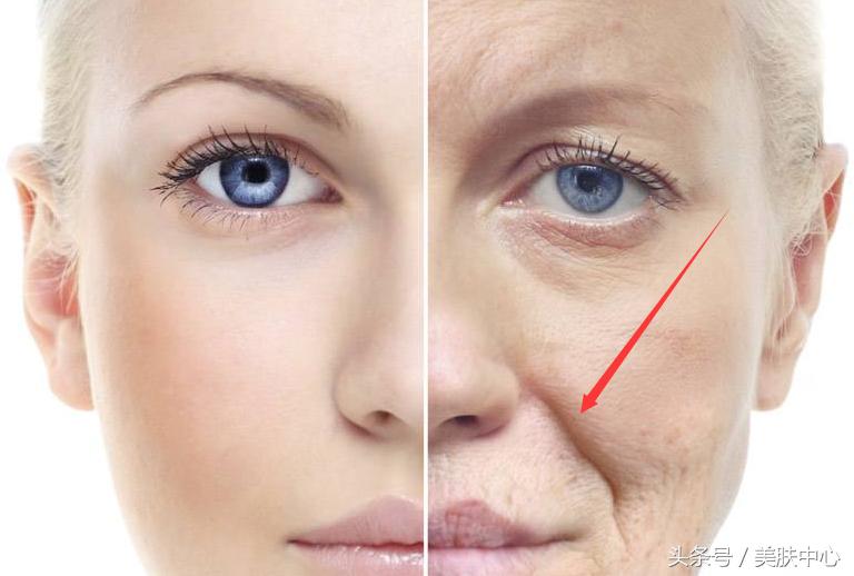 25岁比同龄人还老法令纹很深,20岁法令纹很深是什么原因