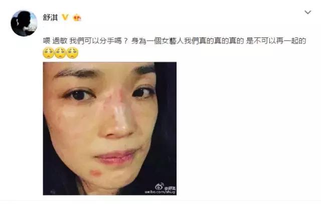 换季肌肤敏感怎么解决,秋季脸部敏感泛红是怎么了