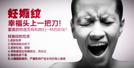 怀孕大肚子长妊娠纹抹橄榄油,怀孕后长妊娠纹怎么处理