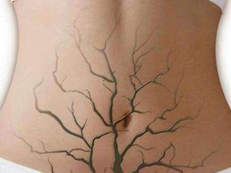 只用这一招就搞定了便秘,转一转缓解便秘