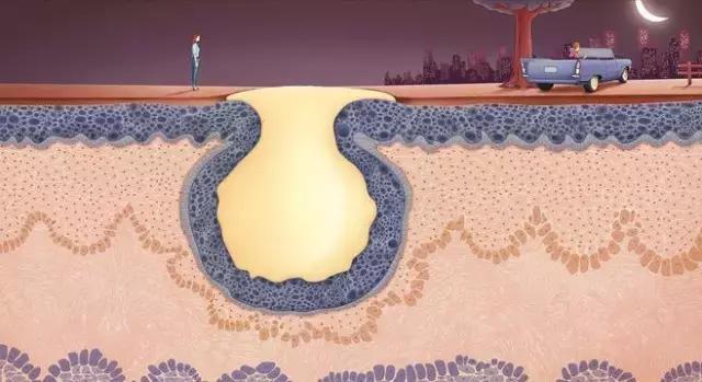 祛痘痘的正确护肤方法,长痘祛痘用什么方法最有效